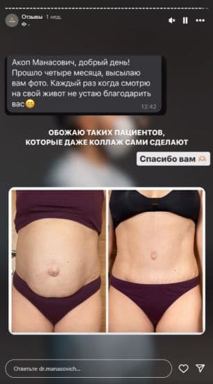 Example preview